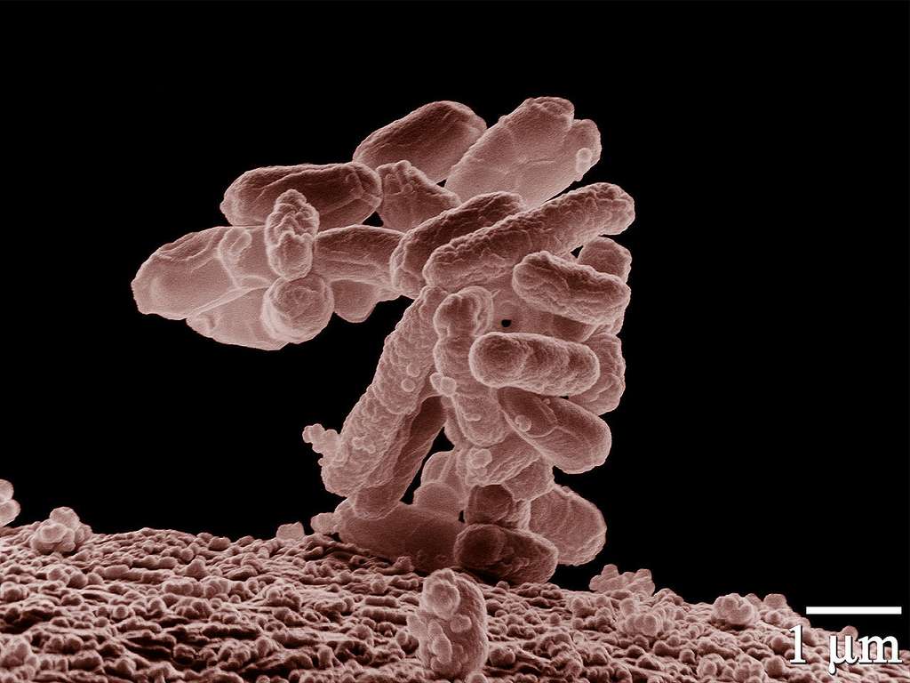 La fameuse Escherichia coli, la bactérie très utilisée dans la recherche biologique, se retrouve dans notre flore intestinale et contribue à notre digestion. Elle et ses consœurs pourraient nous préserver des allergies. Un bel exemple de symbiose ! © Erir Erbe, Agricultural Research Service, Wikipédia, DP