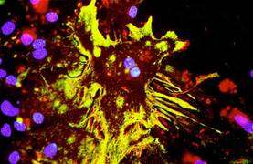 Double marquage immunocytochimique d'un astrocyte en culture. En vert-jaune, une protéine spécifique des astrocytes, la GFAP. En rouge, une protéine du métabolisme cellulaire, la lactate déshydrogénase. En bleu-violet, les noyaux des cellules. © Karin Pierre, Institut de Physiologie, UNIL, Lausanne, DR