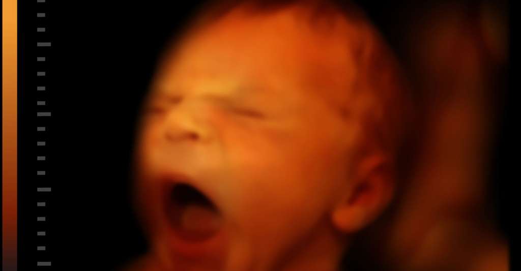 Grâce à l'échographie, on peut voir le bâillement d'un bébé. © Valentina Razumova, Shutterstock