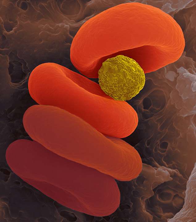 Un montage d'une image d'artiste montrant une des microparticules des chercheurs américains avec des globules rouges. © D. Kunkel/Dennis Kunkel Microscopy Inc., D. Bell/Harvard University, J. Kheir/BostonChildren’s Hospital, C. Porter/Chris Porter Illustration
