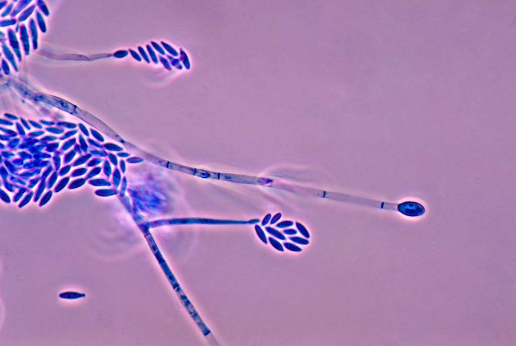 Sur cette image, on voit les conidiophores et les conidies du champignon Fusarium verticillioides. Faisant partie de la flore des champs, ce champignon ne se développe pas sur les grains une fois récoltés. © CDC, Libero Ajello, DP