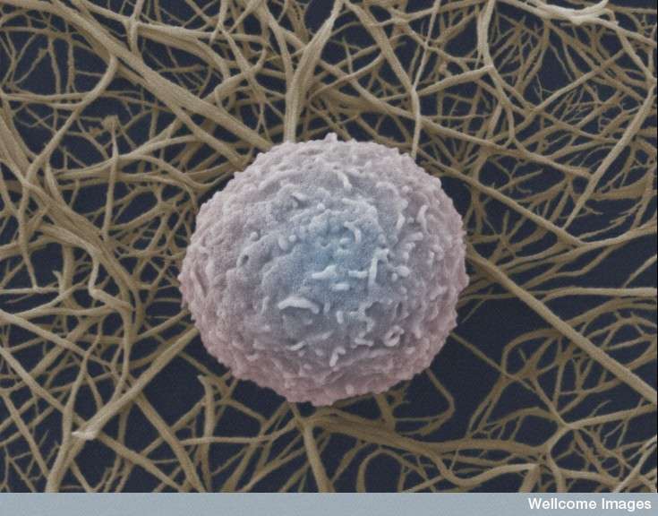 Les globules blancs, dont font partie les lymphocytes, sont des cellules du système immunitaire fabriquées dans la moelle osseuse. Dans le cas d'une greffe de cet organe, elles peuvent agresser le corps du receveur, puisqu'il est étranger à ces cellules. C'est la cause de la réaction aiguë du greffon contre l'hôte. © Anne Weston, Wellcome Image, Flickr, cc by nc nd 2.0
