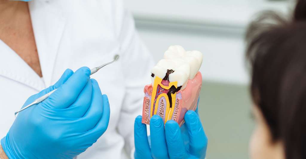 Le déchaussement des dents. © Alexander Egizarov, Shutterstock