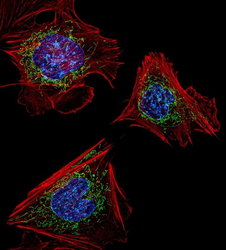 Des fibroblastes fluorescents Des fibroblastes fluorescents