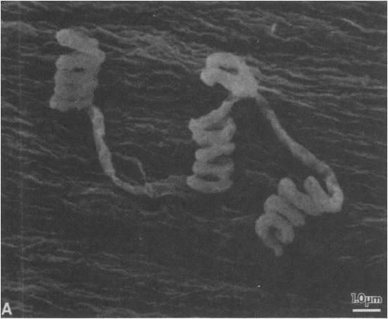  Streptomyces avermitilis : bactérie vivant dans le sol. © Hyun Tae-Woong, Wikimedia Commons, CC by-sa 4.0