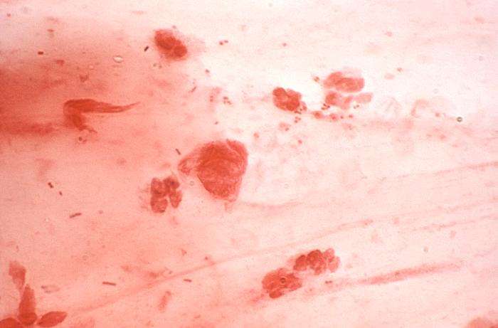 La bactérie Neisseria gonorrhoeae est responsable de la gonorrhée, ou blennorragie, une infection sexuellement transmissible. © Joe Miller, Centers for disease control and prevention (CDC), domaine public