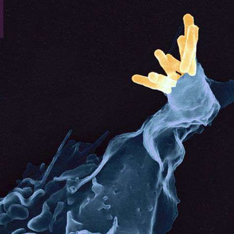 Bacille de Koch (Mycobacterium tuberculosis) plus connu sous le petit nom de tuberculose. © AJC1, Flickr, cc by-nc 2.0