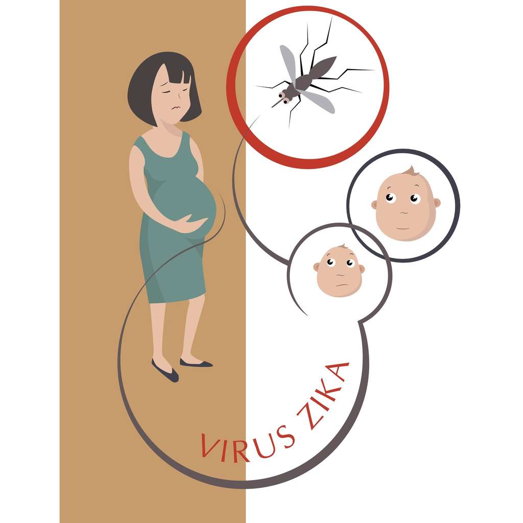 Si un moustique infecté transmet le Zika à une femme enceinte, le bébé risque de souffrir de microcéphalie. © whilerests, Fotolia