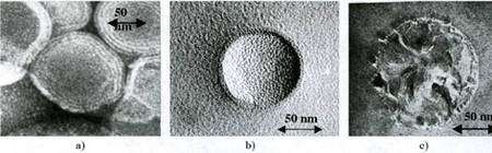 Fig 9 : liposomes (a), nanosphères (b) et nanocapsules (c).