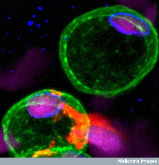 Les cellules cancéreuses prolifèrent de façon autonome dans l'organisme. Elles ne répondent pas au cycle cellulaire normal. © Dr. Yi Feng, University of Bristol, Wellcome Images/Flickr CC by nc-nd 2.0