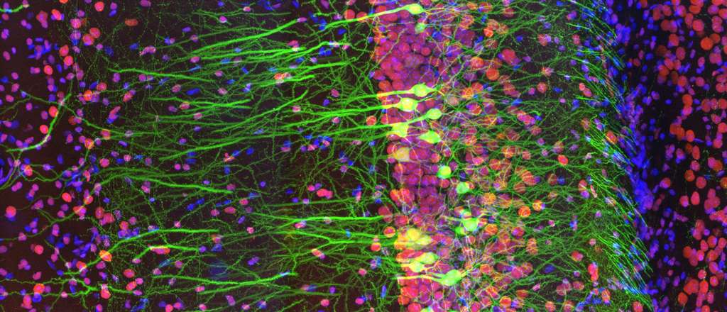 Immunocoloration de tranche de cerveau de souris Thy1-EGFP avec deux fluorophores. © Ainara Pintor (Espagne), Olympus