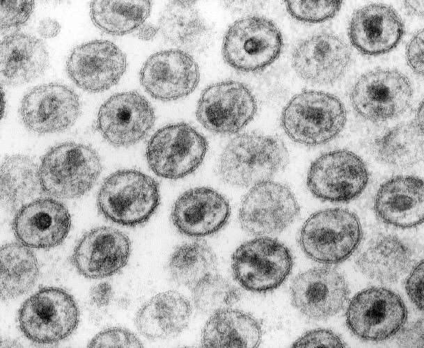 VIH-1. Micrographie électronique à transmission. © CDC/Dr. Edwin P.Ewing, Jr., Wikimedia Commons, domaine public