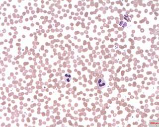 Infusion de gingembre : quels sont ses bienfaits et comment la préparer