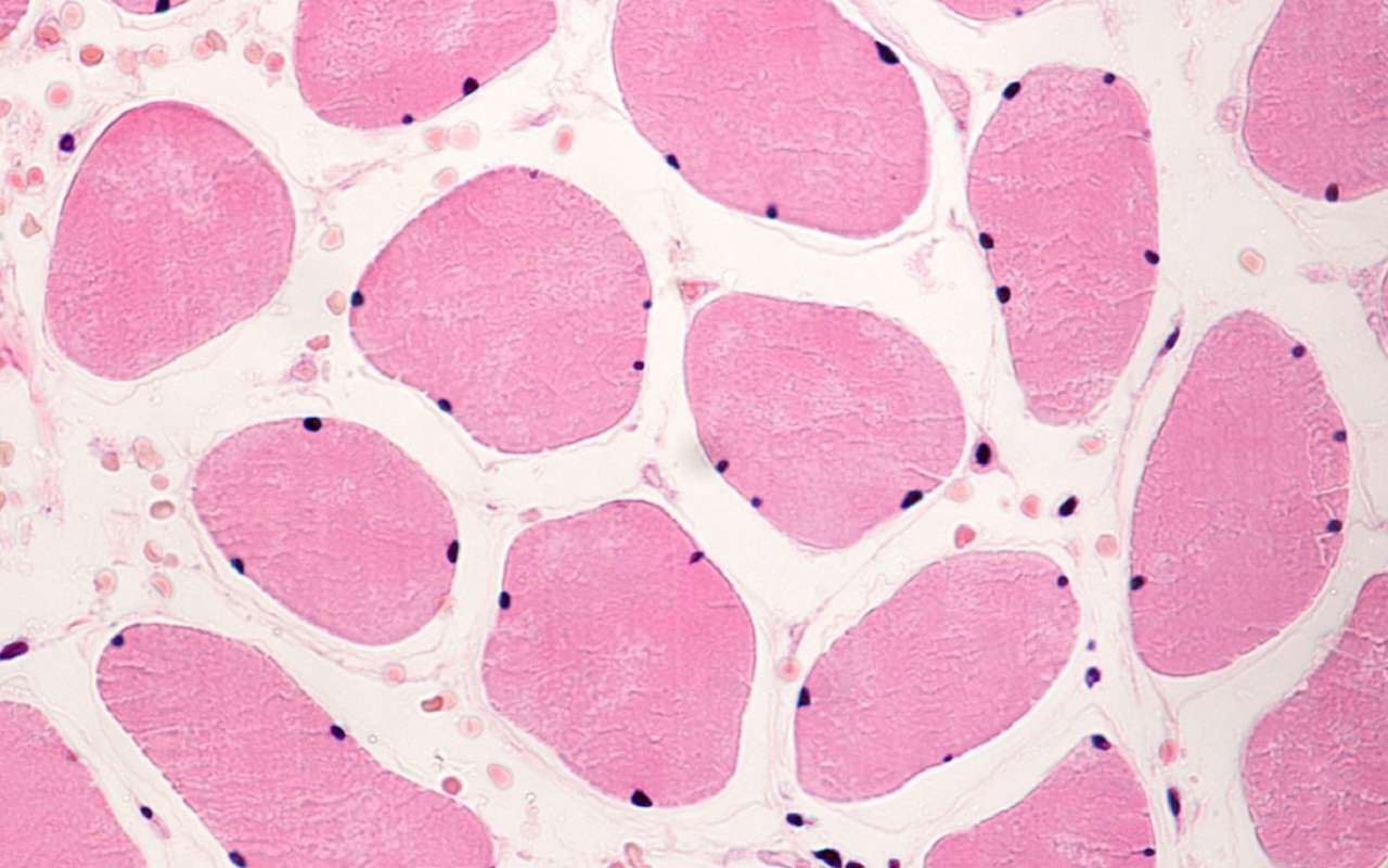 Définition  Myocyte : structure et fonctionnement