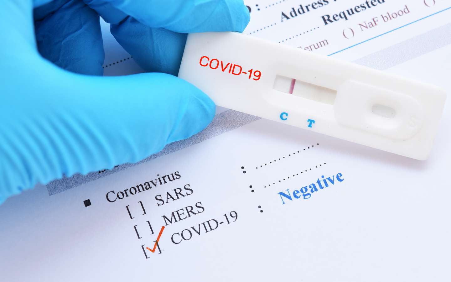Test de salive à l'antigène COVID
