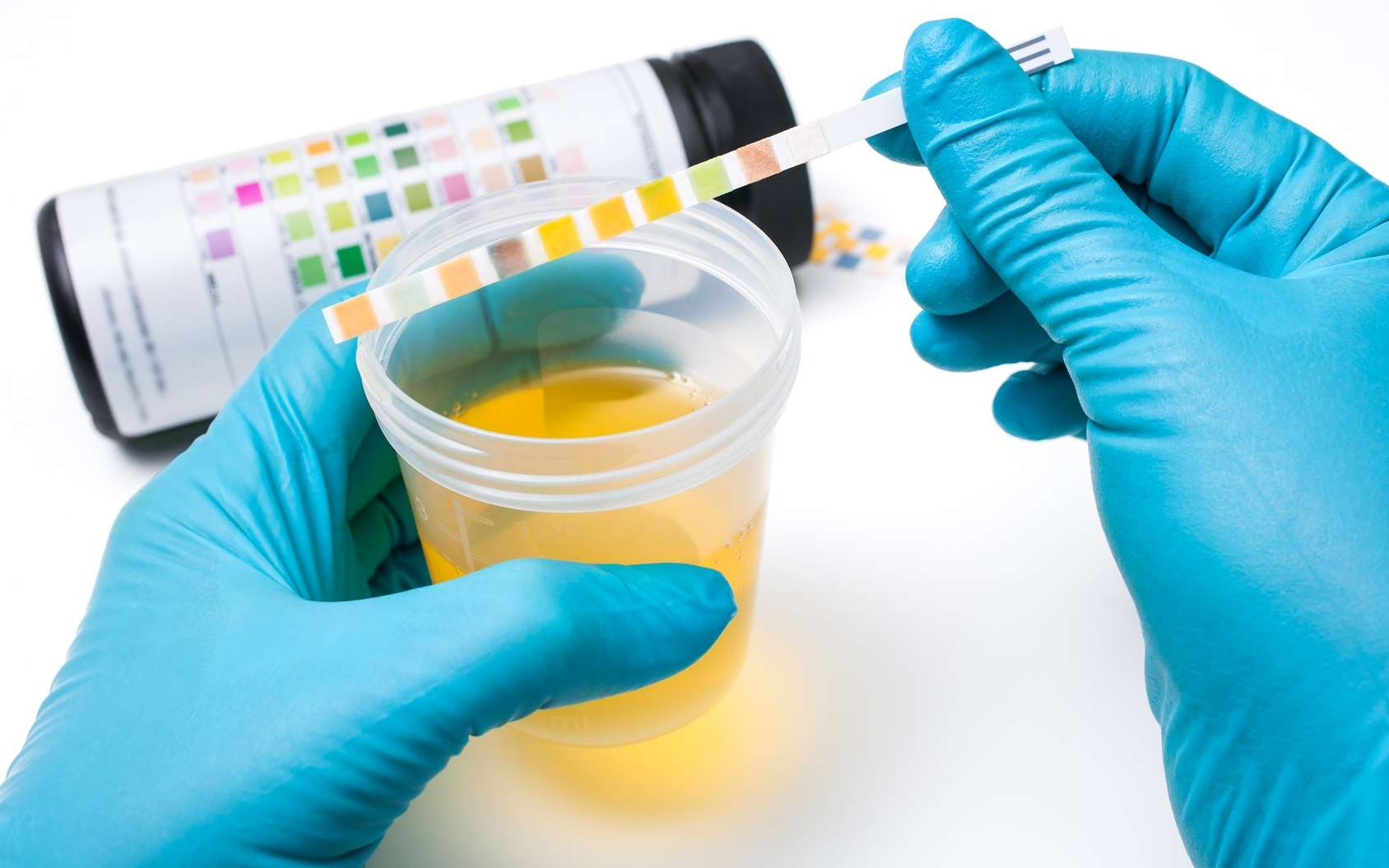 l urine est elle sterile