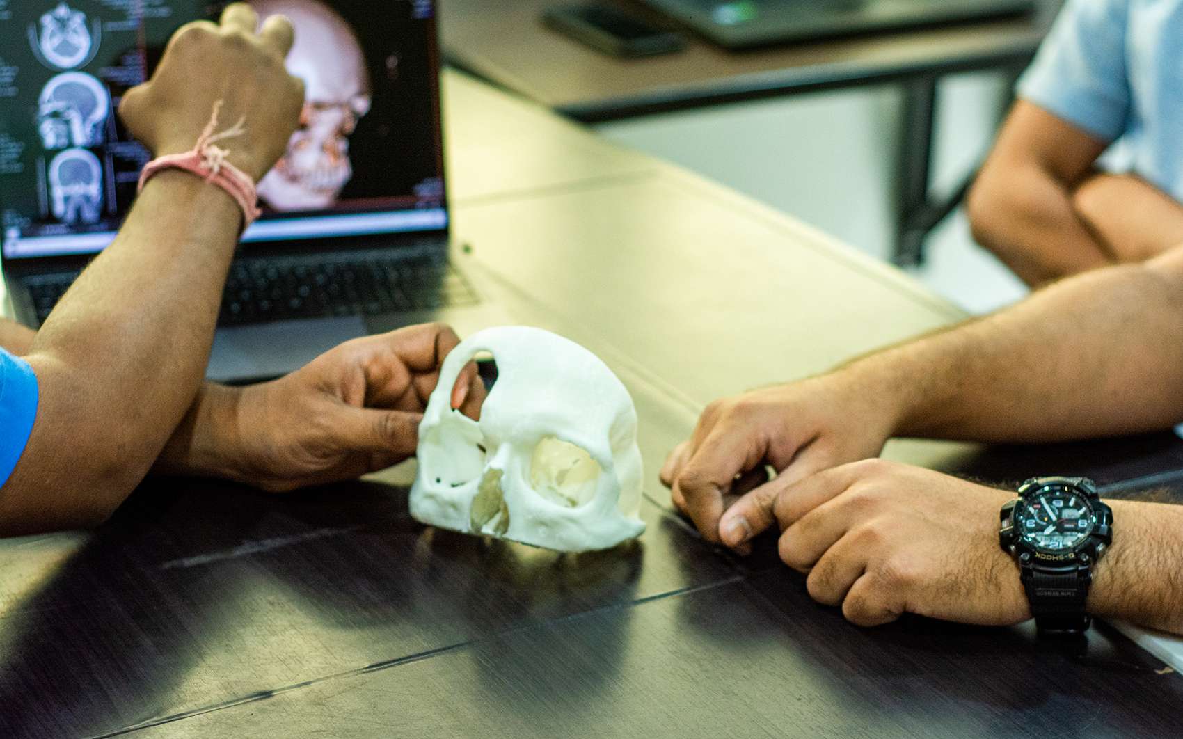 Des implants imprimés en 3D promettent de démocratiser l'accès aux soins