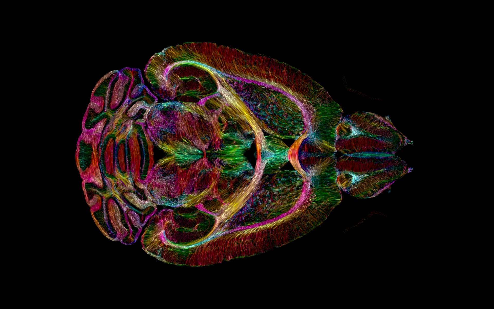 Des images d'un cerveau 64 millions de fois plus détaillées qu'avant !
