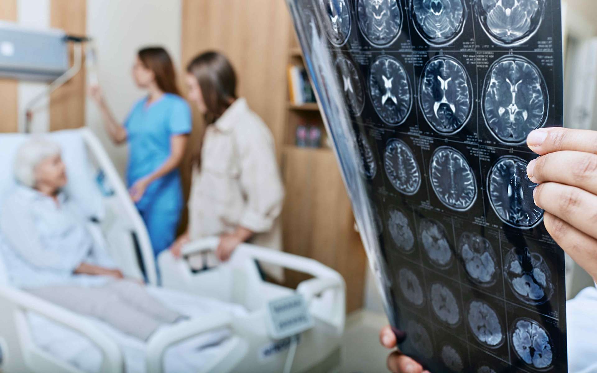 L'accumulation de fer dans le cerveau peut déclencher la maladie d'Alzheimer
