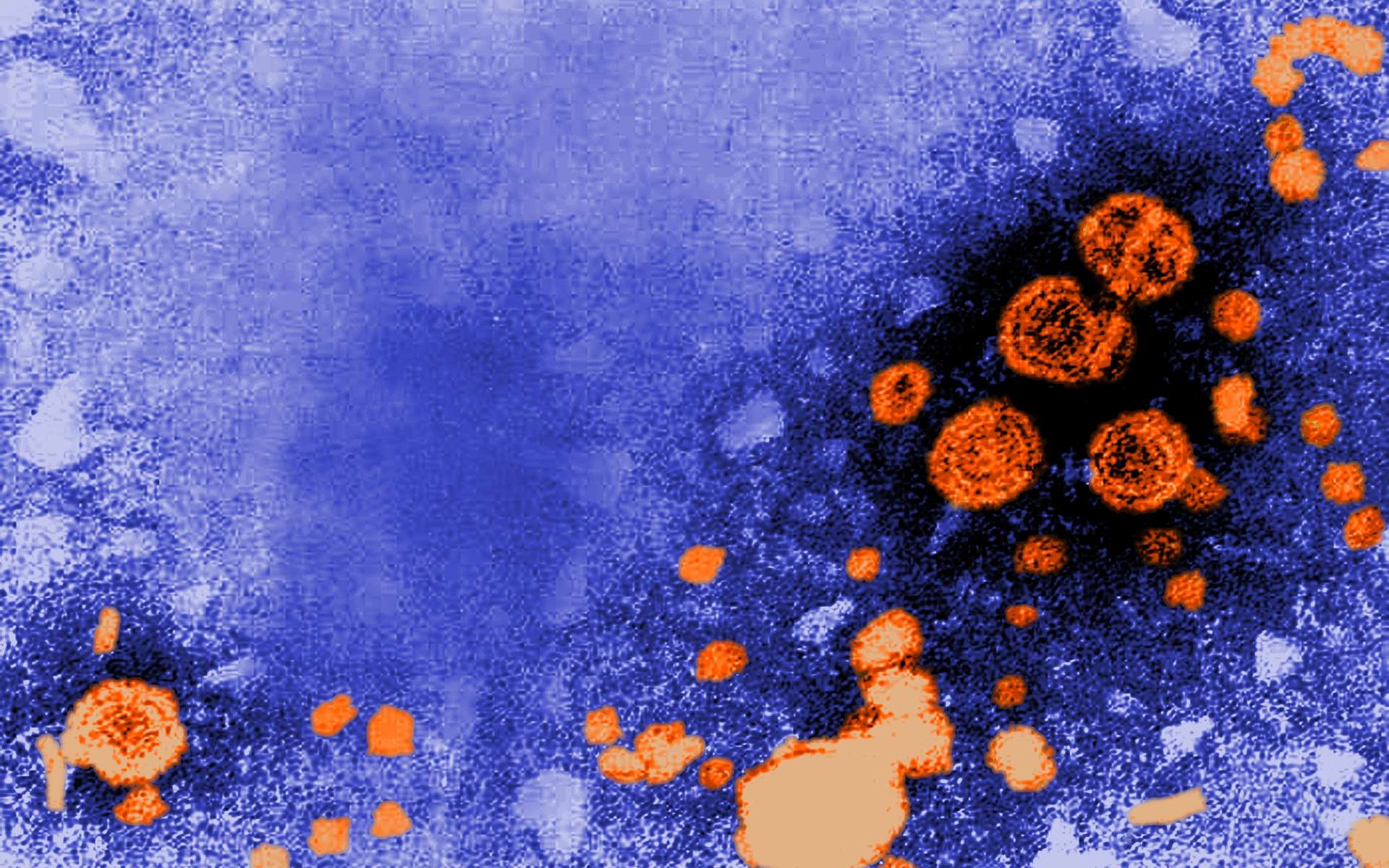 Le virus de l'hépatite B. © US Centers for Disease Control
