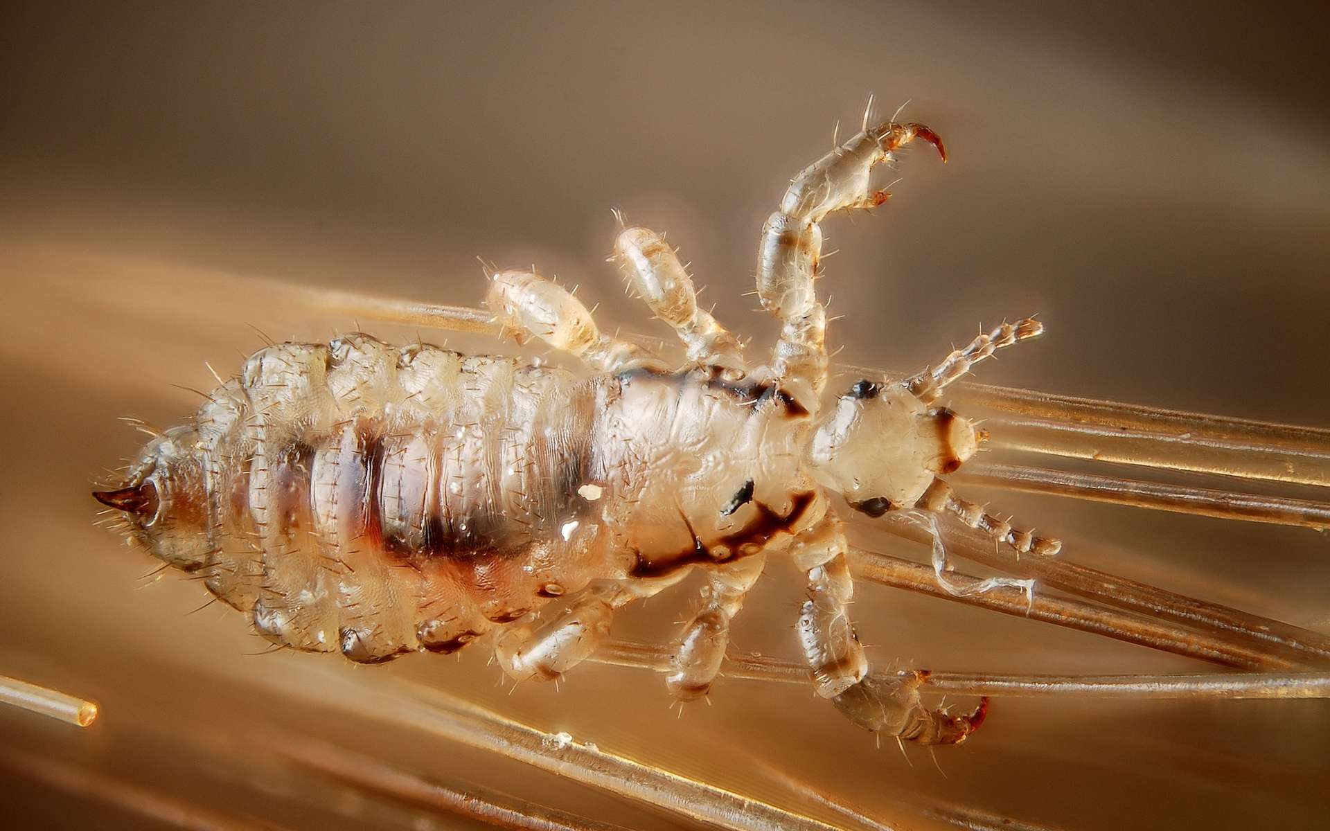 Amibes, larves, vers... Les pires parasites du corps humain. © Gilles San Martin, Flickr