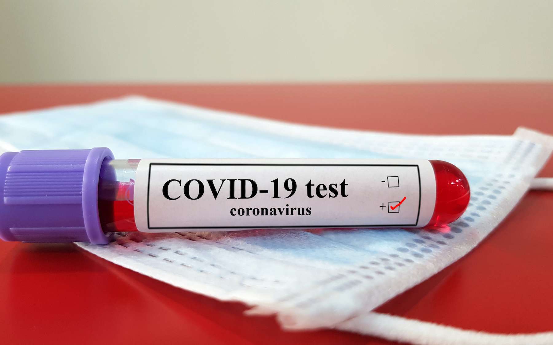 Bientôt un test pour diagnostiquer la Covid longue ?