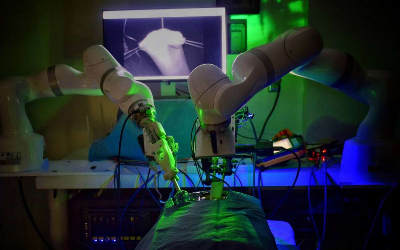 Photo of ¡Un robot a réalisé es una operación quirúrgica sin asistencia humana con un resultado «significativement meilleur»!