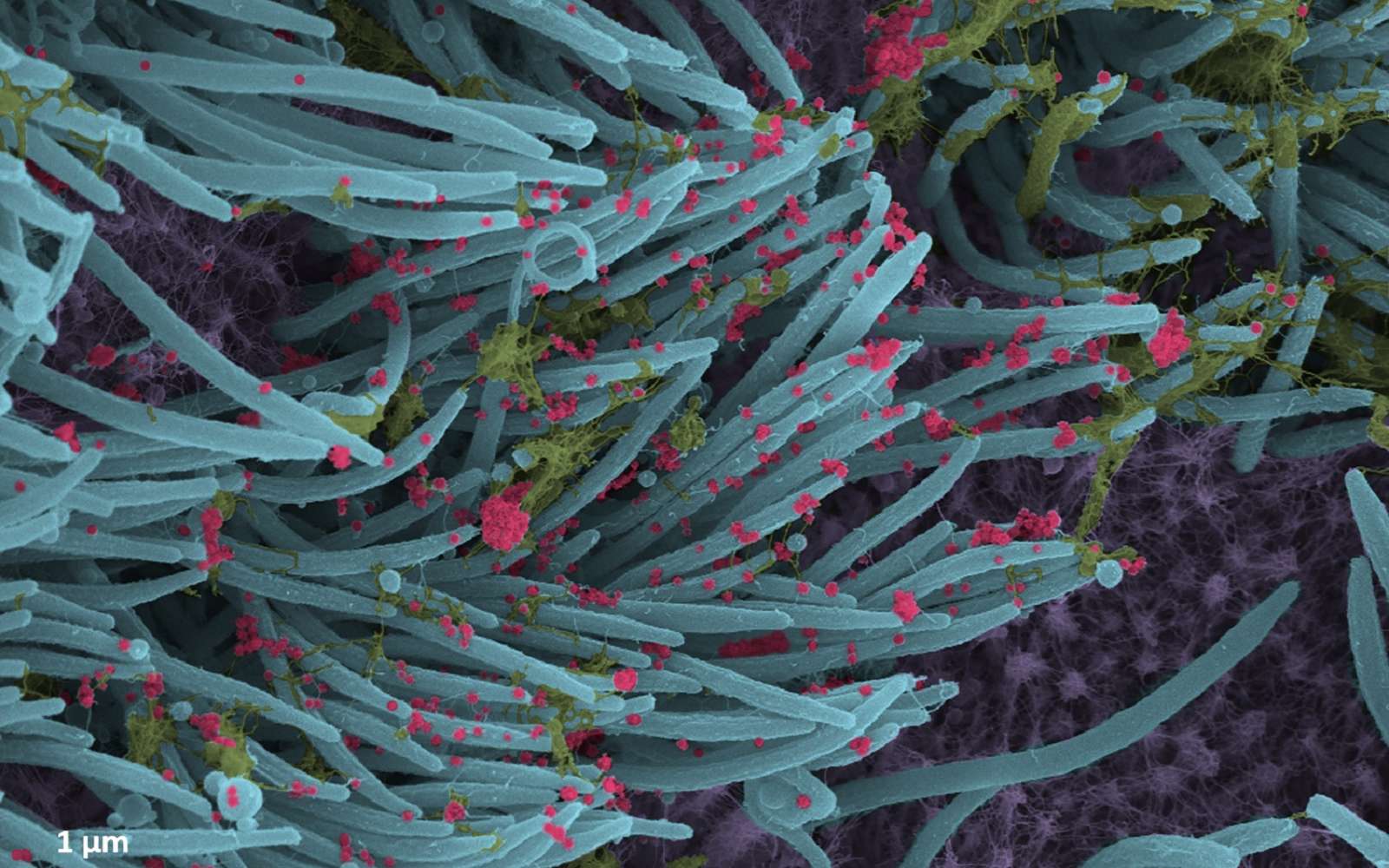 Covid-19 : voici ce à quoi ressemble le virus dans vos voies respiratoires