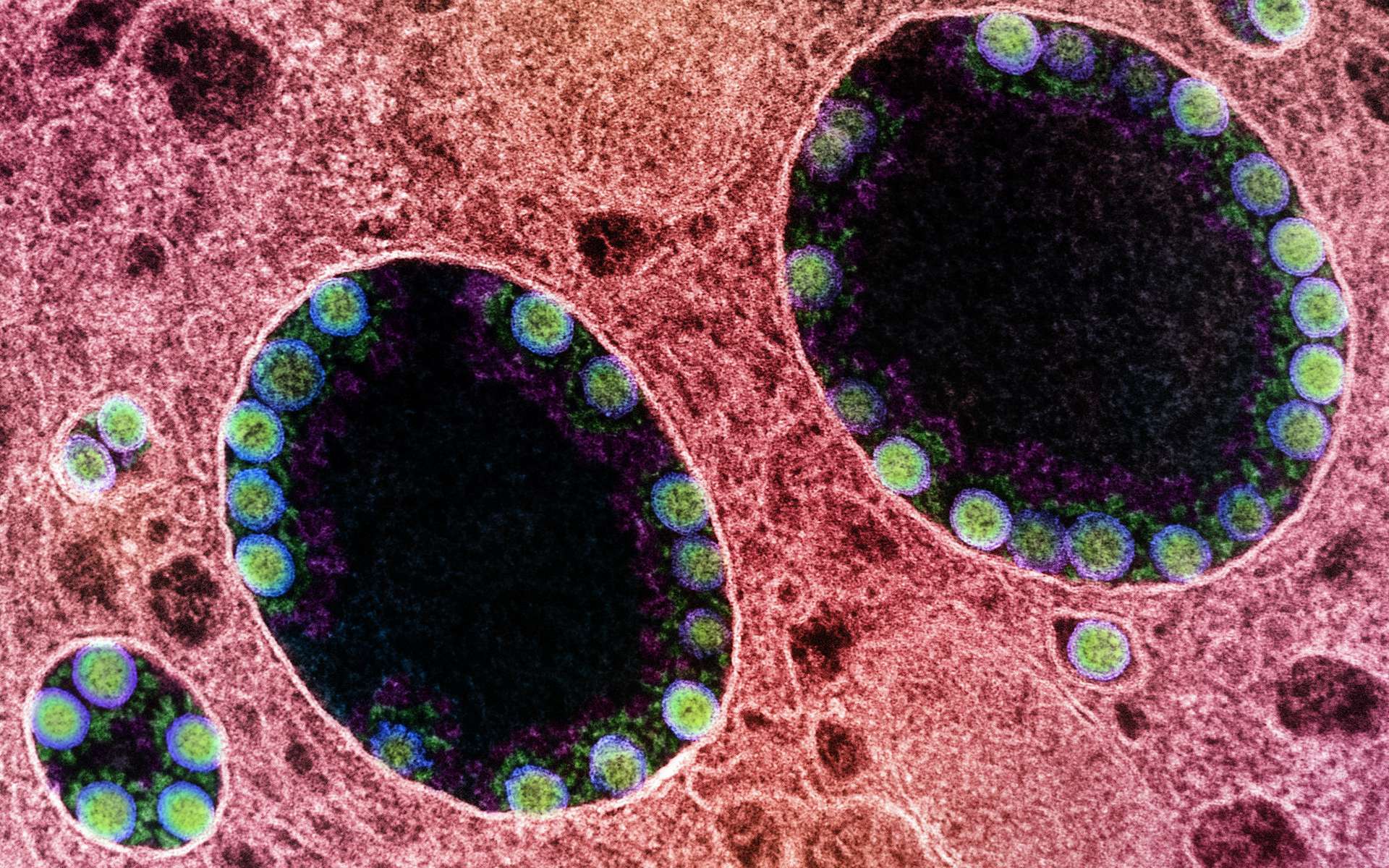 Des particules virales de SARS-COV-2 (en jaune) infectant des cellules nasales. © Niaid