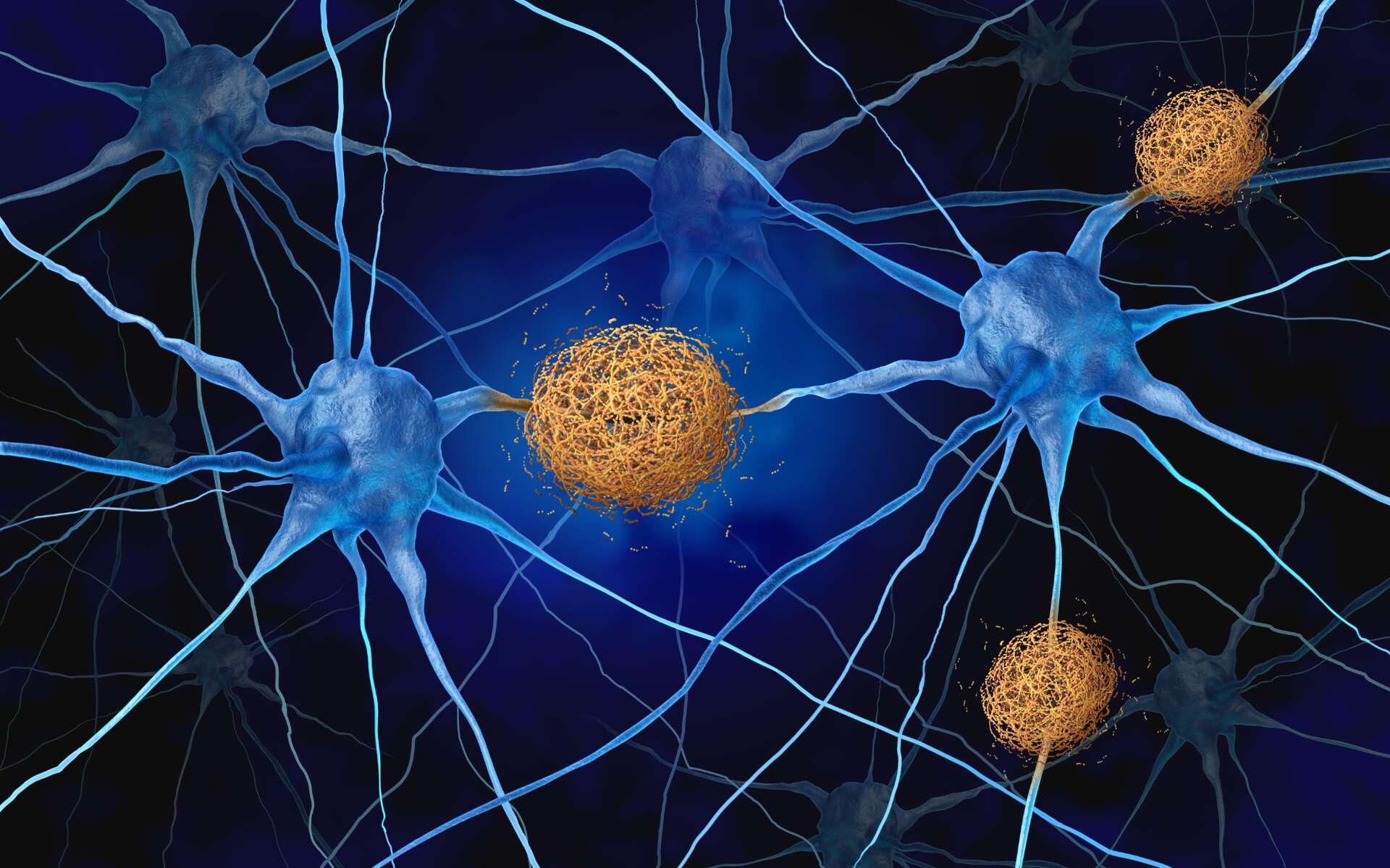 Quand une protéine d'Alzheimer révèle un pouvoir secret capable d'aider à vaincre le cancer