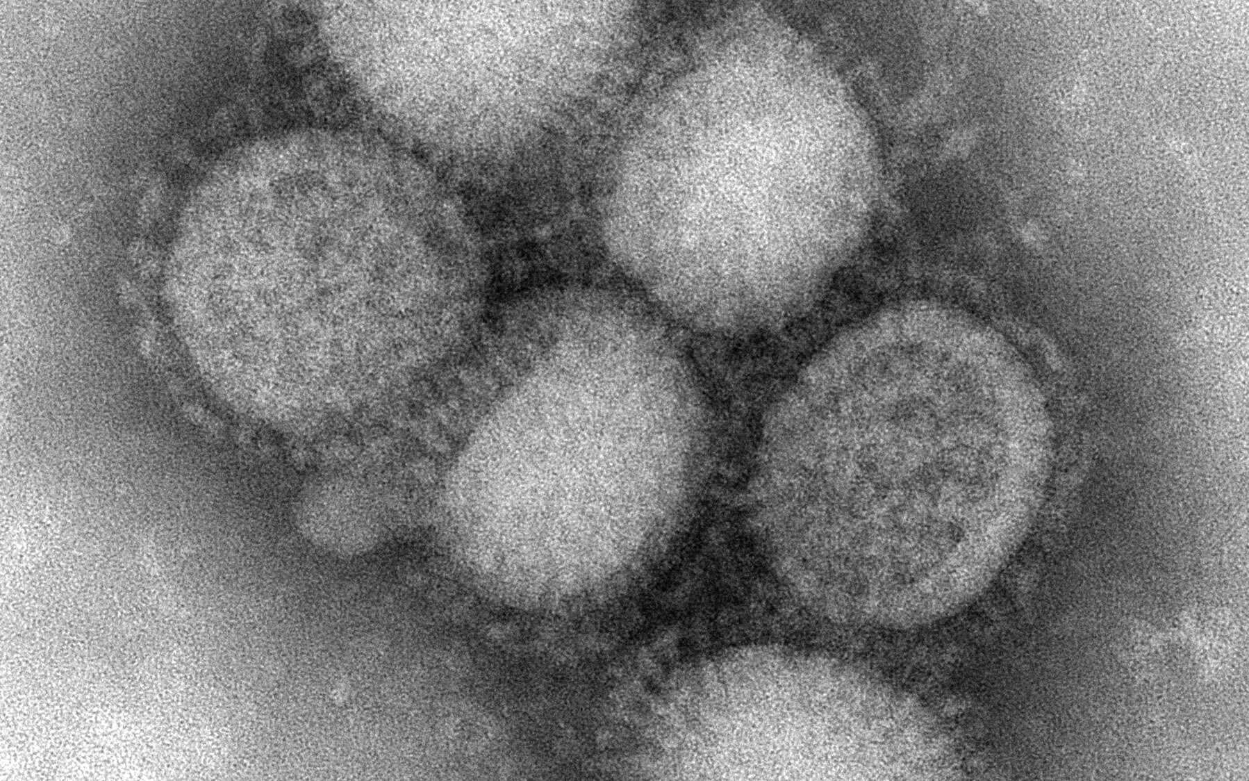 Le virus A(H1N1). Des millions de personnes l'ont rencontré et vaincu. © Centers for Disease Control and Prevention