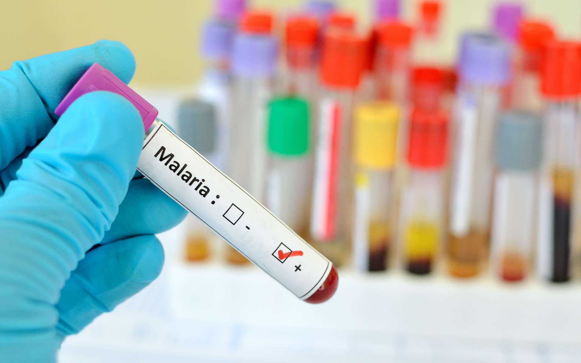 Le café et le chocolat favorisaient le risque de malaria dans les pays en développement
