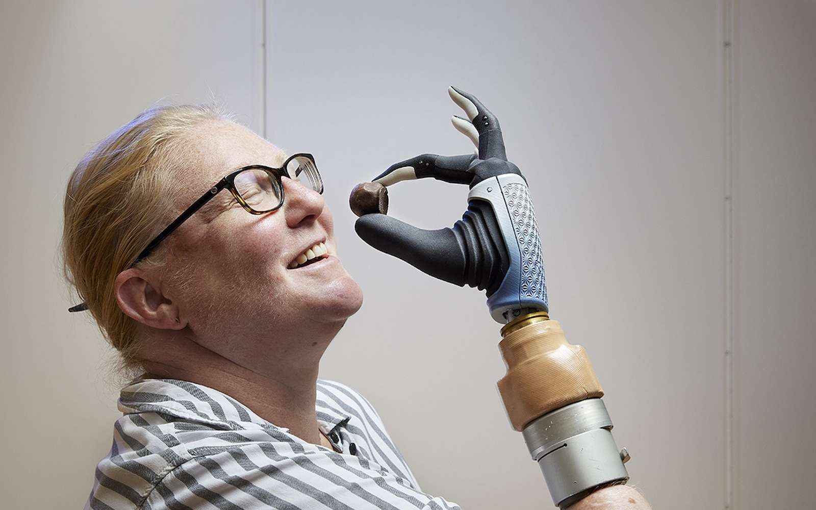 Cette incroyable main bionique a changé la vie de cette patiente