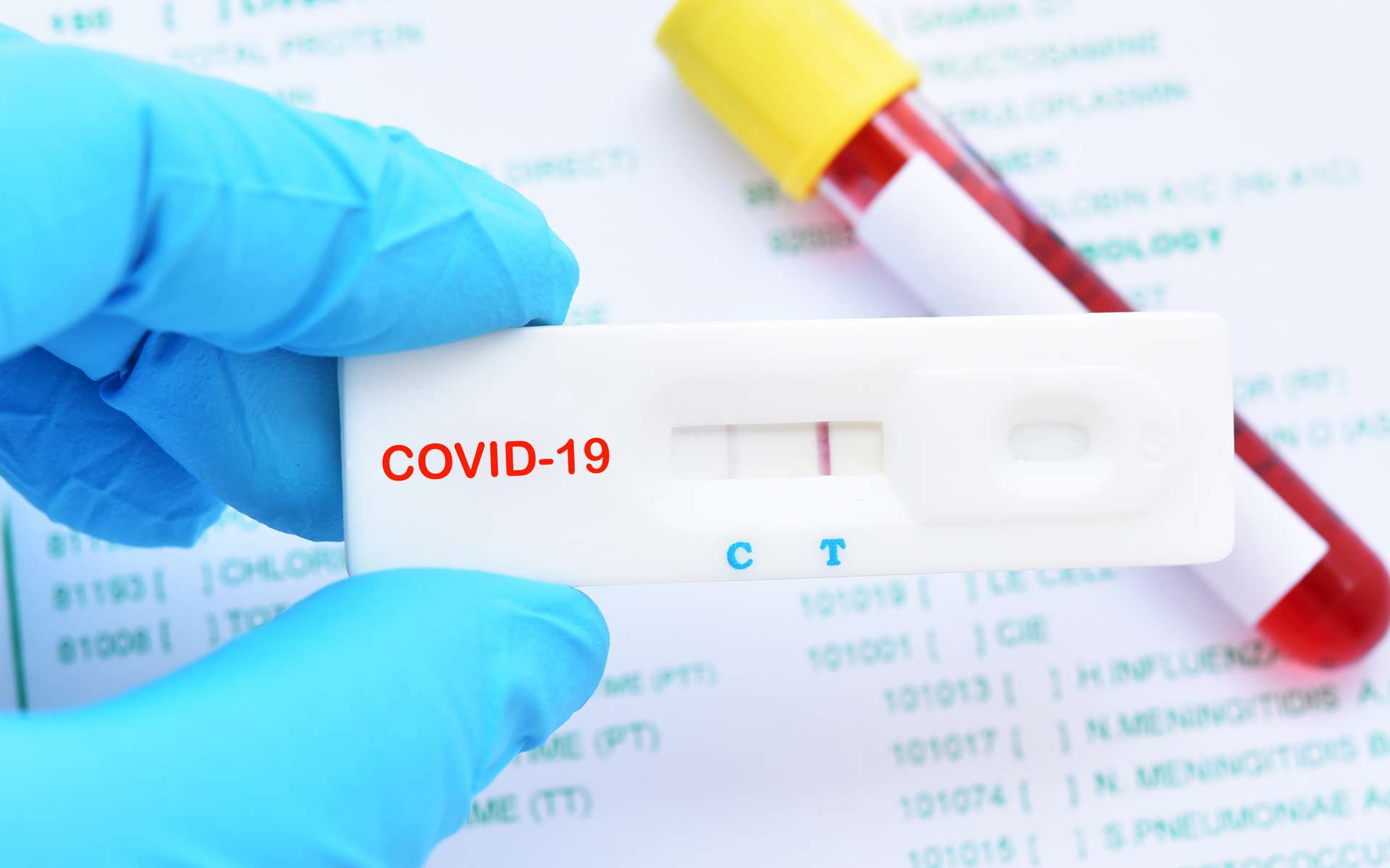 Illustration d'un test positif pour le Covid-19. © jarun011, Adobe Stock