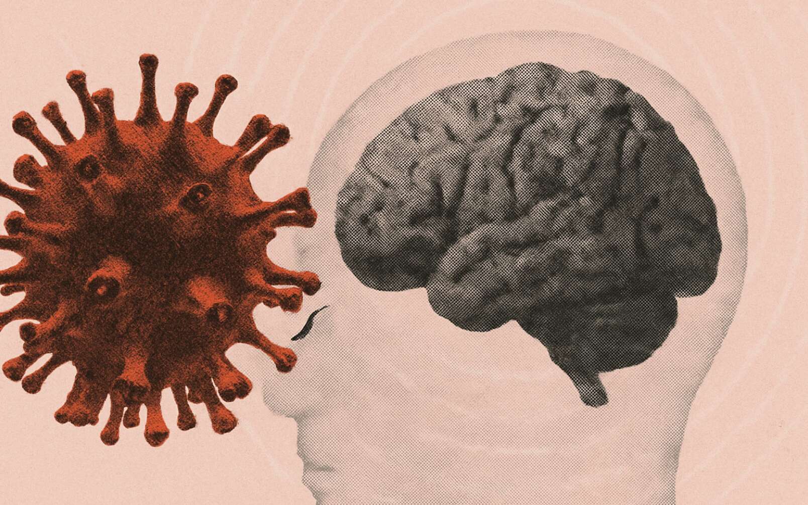 Ces virus courants pourraient favoriser Alzheimer ou Parkinson, révèle une étude sur 500 000 cerveaux