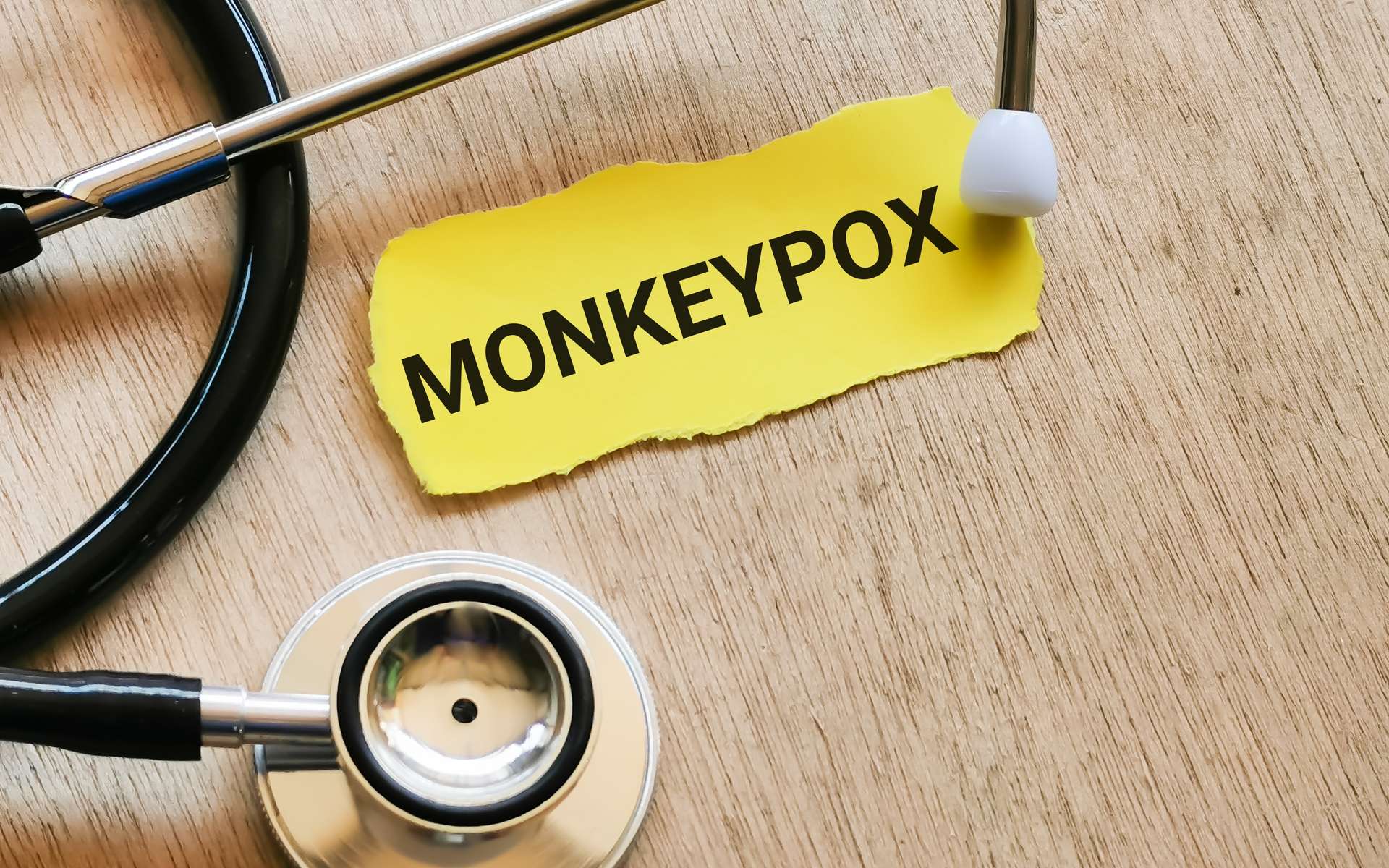 Variole du singe ou monkeypox : un premier cas confirmé en France
