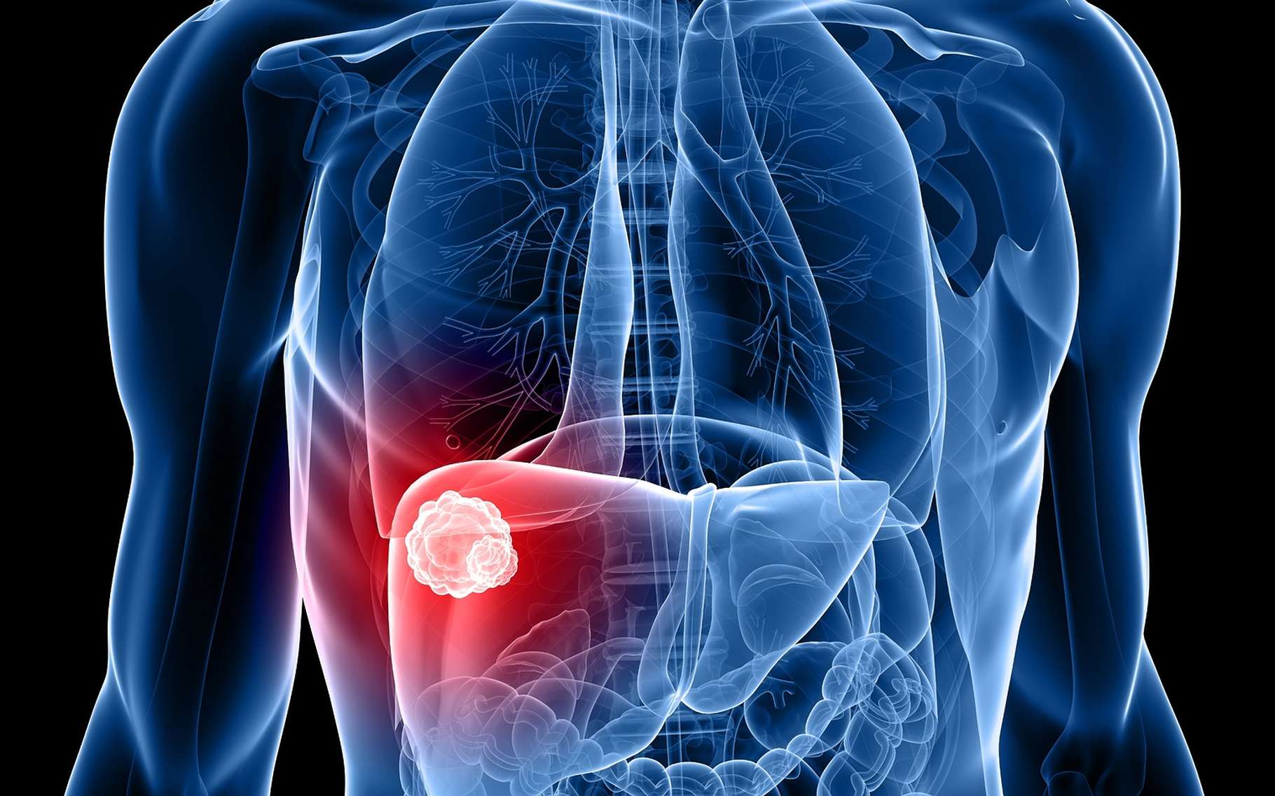 Le cancer du foie est dans 80 % des cas masculin. © Sebastian Kaulitzki, Shutterstock