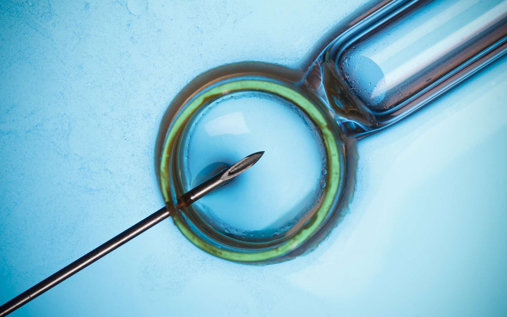 La technique consiste à transplanter le pronucleus de l’œuf (le matériel génétique du noyau obtenu juste après la fécondation) dans un autre œuf, dont les mitochondries sont saines. © nevodka, Shutterstock