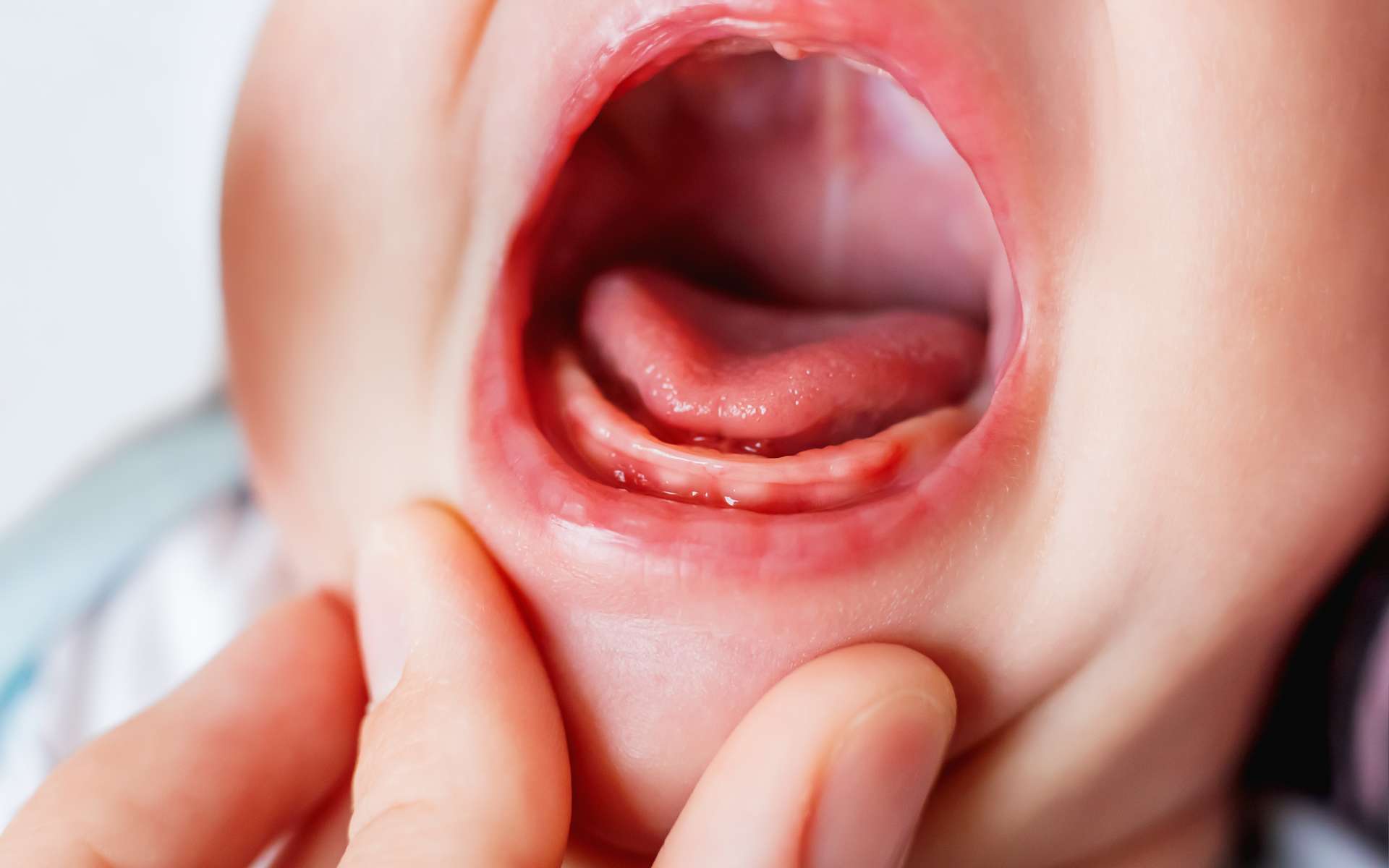 Pourquoi diagnostiquer tôt le frein de langue est-il si important pour le développement du bébé ? © kittyfly, Adobe Stock