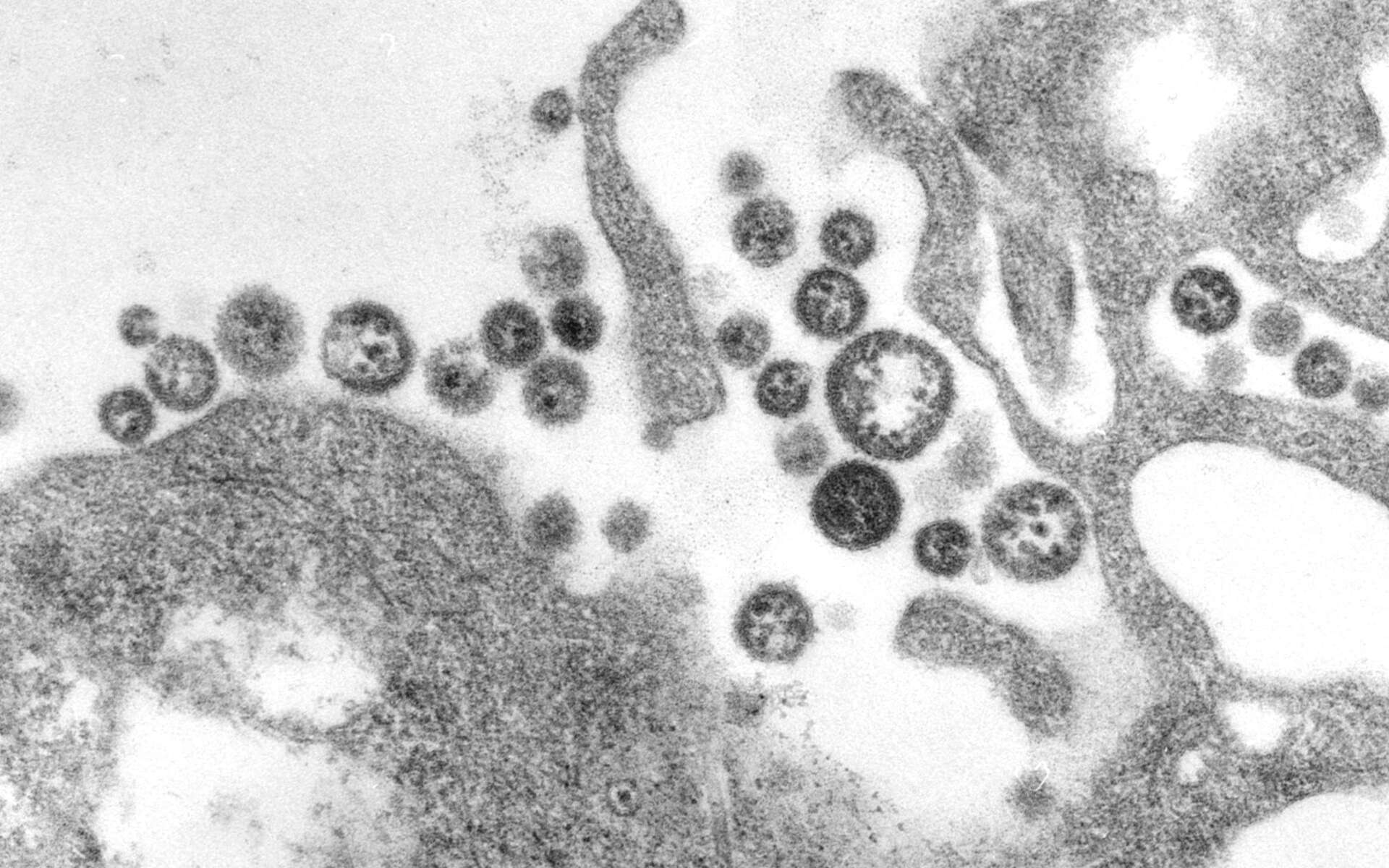 Image du virus de la fièvre de Lhassa, un virus faisant partie du même groupe que le virus Chapare. © CDC's Public Health Image Library