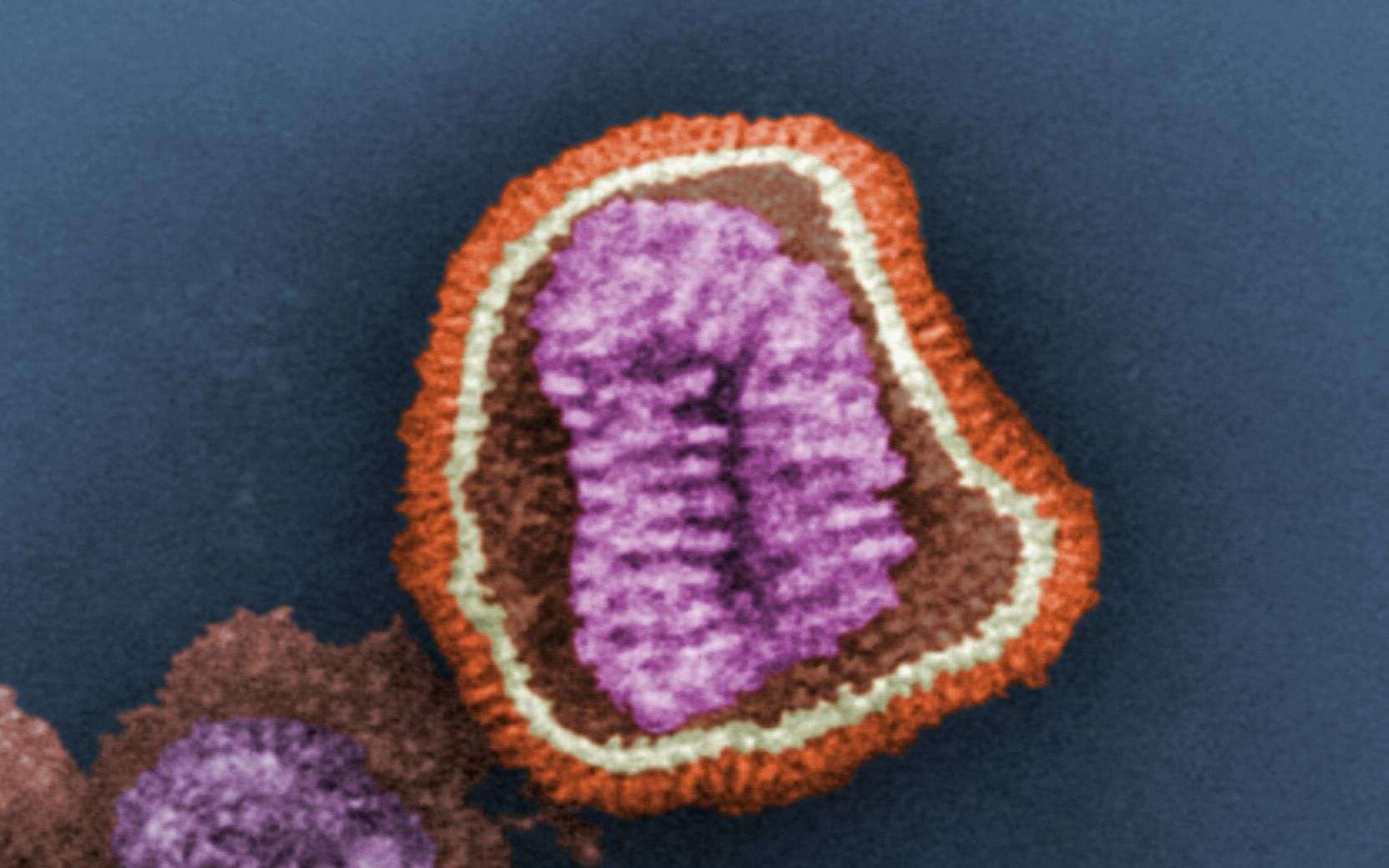 La grippe A(H7N9) causerait des symptômes particulièrement violents chez les adultes en bonne santé, tandis que les oiseaux ne montrent aucun signe de la maladie. © C. Goldsmith, CDC, DP