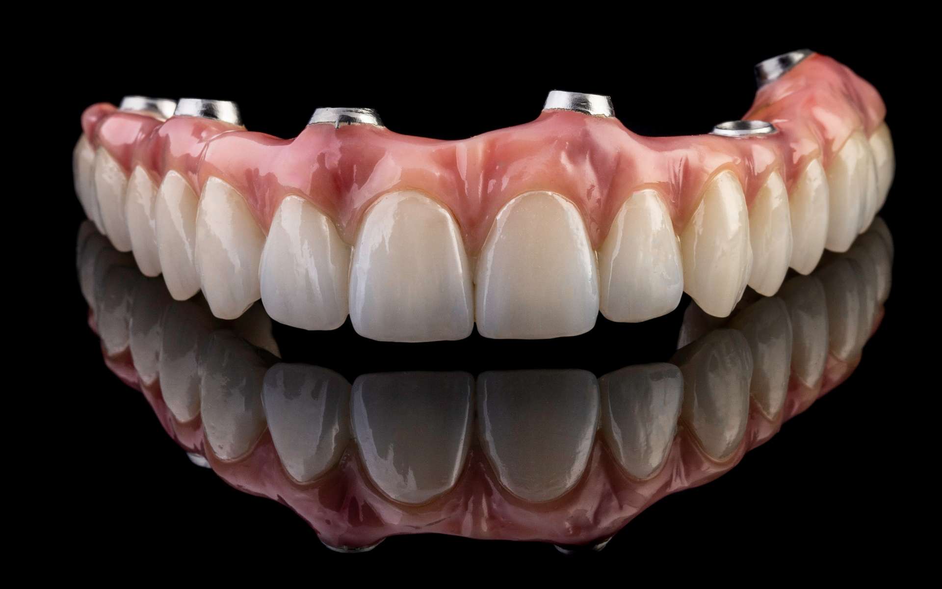 Le sourire d'or d'une aristocrate du XVIIe siècle permet de comprendre les soins dentaires à cette époque