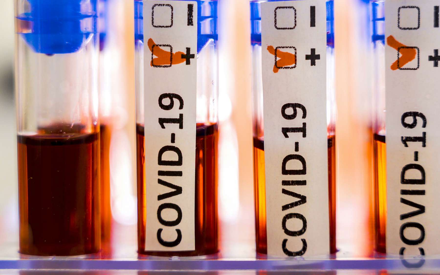 Covid-19 : premier cas confirmé de réinfection