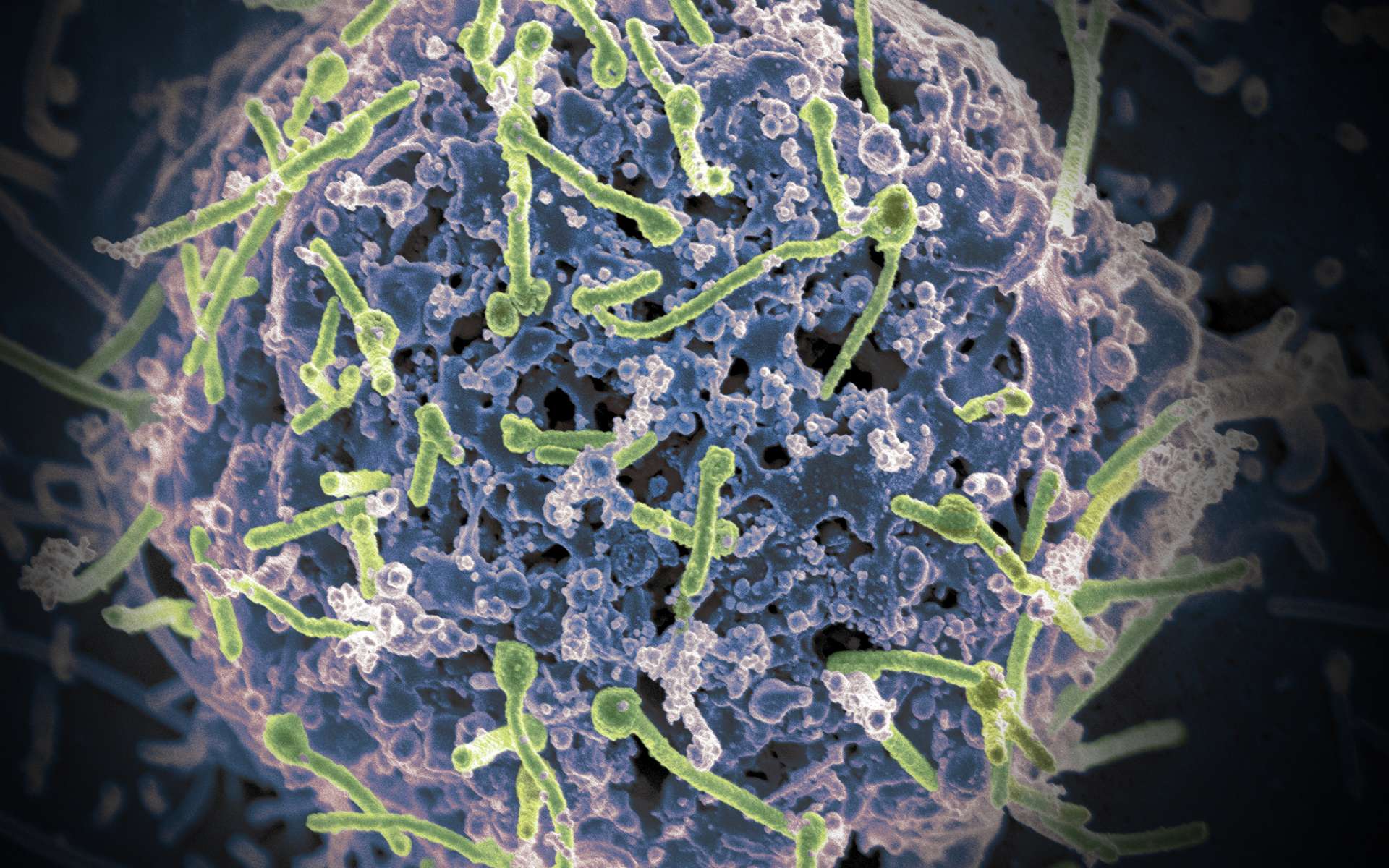 Les particules virales du virus Ebola (en vert) infectant une cellule, vue par microscopie électronique. © Niaid