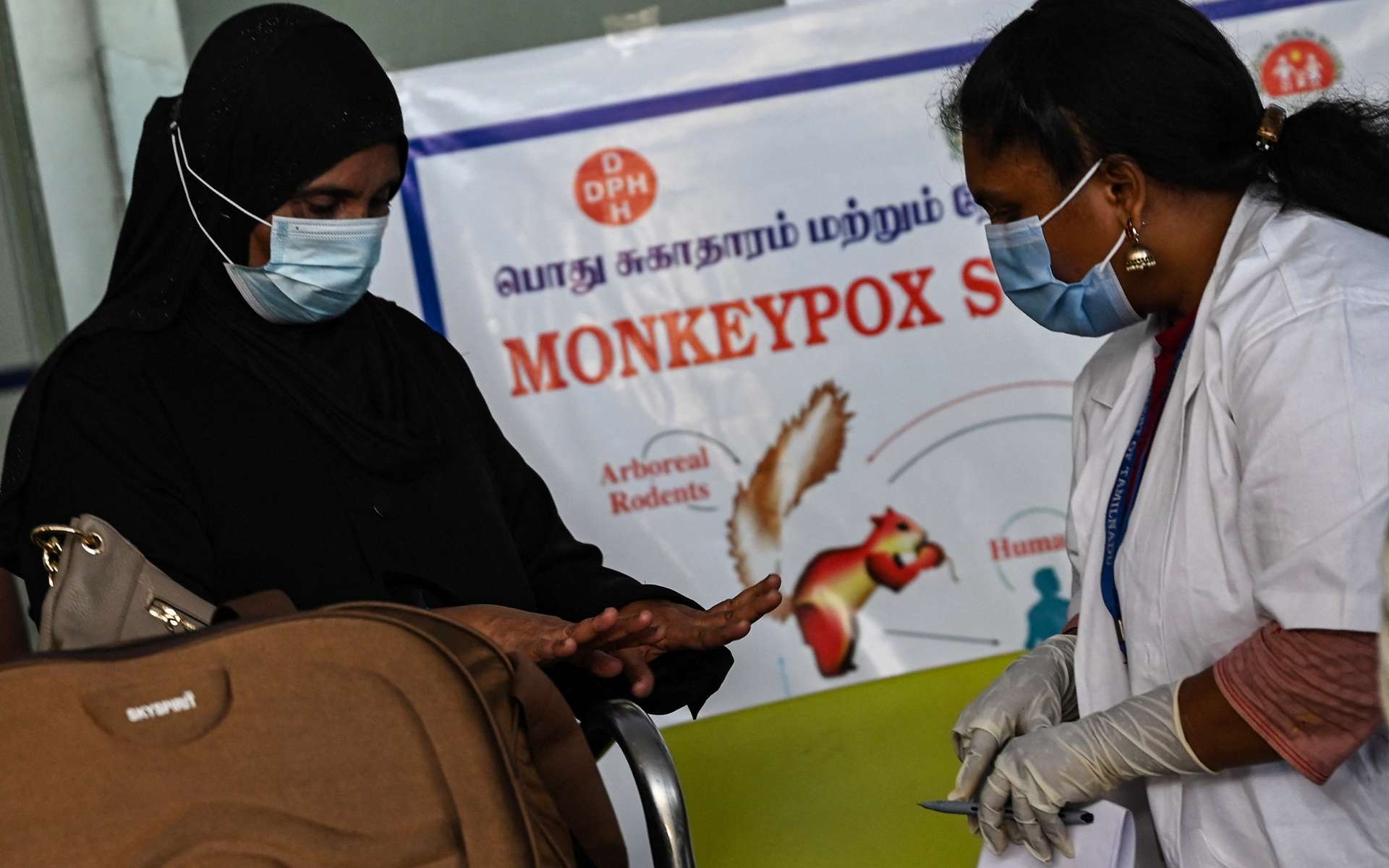 Variole du singe, Monkeypox… L'OMS envisage de modifier le nom des différentes souches du virus, ainsi que celui de la maladie elle-même. © Arun Sankar, AFP