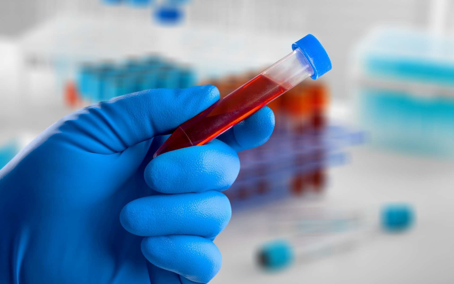 Un test sanguin détecte le cancer colorectal avec une précision de 83 %