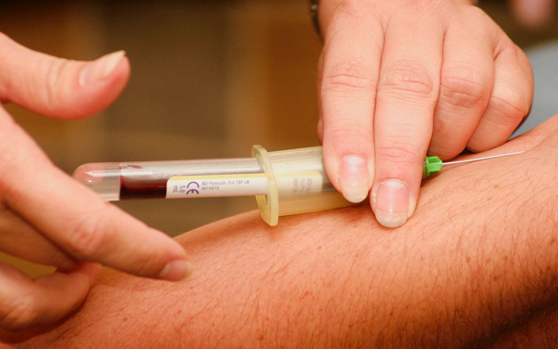 AUn test sanguin permet de savoir si on est séropositif ou pas. ©Photo by Hush Naidoo on Unsplash
