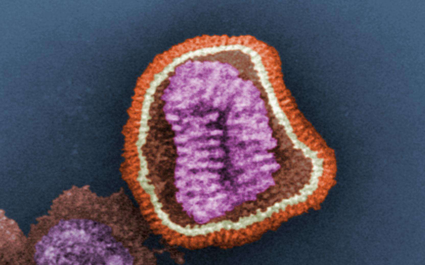 La grippe A(H7N9) causerait des symptômes particulièrement violents chez les adultes en bonne santé, tandis que les oiseaux ne montrent aucun signe de la maladie. Si les volatiles sont réellement à l'origine de la transmission à l'Homme, la tâche des scientifiques n’en sera que plus complexe, car il est impossible visuellement de détecter les animaux contaminés. © C. Goldsmith, CDC, DP