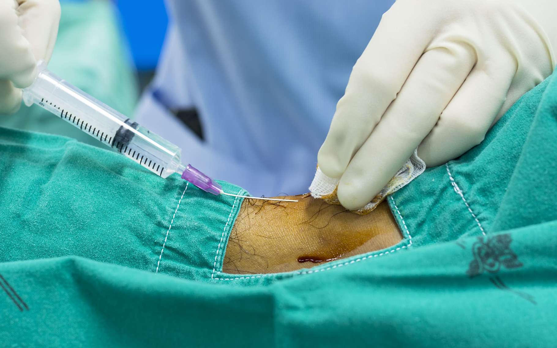 Les infiltrations et myorelaxants pour soulager le mal de dos Dossier