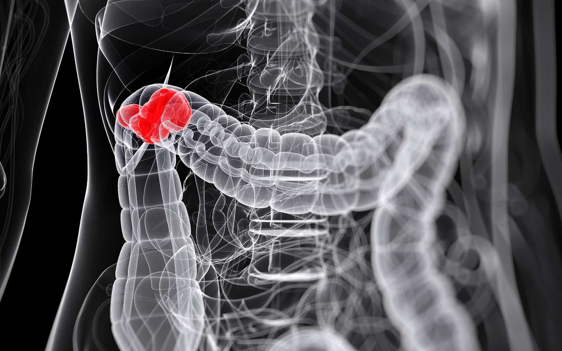 Le côlon représente la majeure partie du gros intestin, entre le cæcum et le rectum. © Sebastian Kaulitzki, Shutterstock
